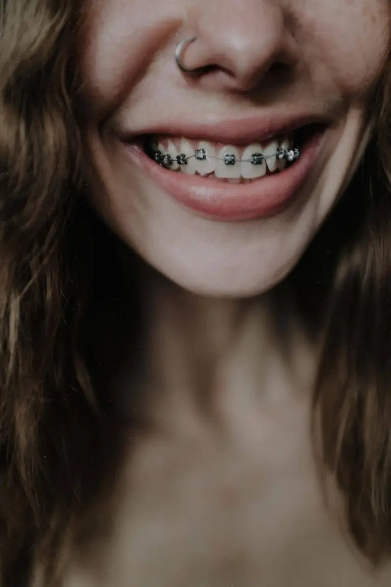 Ortodoncia brackets